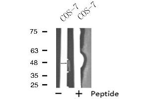 Image no. 1 for anti-Opioid Receptor, kappa 1 (OPRK1) antibody (ABIN6257760)