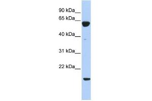 Image no. 1 for anti-Protein Tyrosine Phosphatase Type IVA, Member 3 (PTP4A3) (Middle Region) antibody (ABIN631230)