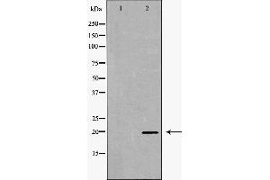 Image no. 2 for anti-Ras Homolog Enriched in Brain (RHEB) (Internal Region) antibody (ABIN6264731)
