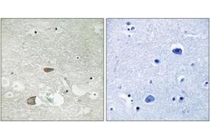 Image no. 1 for anti-Cadherin EGF LAG Seven Pass G-Type Receptor 2 (CELSR2) (AA 2781-2830) antibody (ABIN1534327)