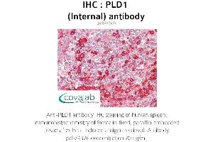 Image no. 1 for anti-Phospholipase D1 (PLD1) (Internal Region) antibody (ABIN1738146)