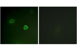 Immunofluorescence analysis of COS7 cells, using p90 RSK (Phospho-Thr573) Antibody.