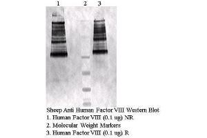 Image no. 1 for anti-Coagulation Factor VIII (F8) antibody (ABIN491135)