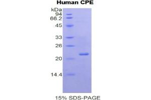 Image no. 4 for Carboxypeptidase E (CPE) ELISA Kit (ABIN6730971)