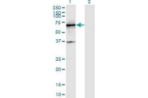 Western Blot analysis of PTPRN expression in transfected 293T cell line by PTPRN monoclonal antibody (M07), clone 8E3.