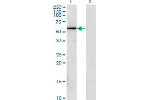 Western Blot analysis of FGFR1OP expression in transfected 293T cell line by FGFR1OP monoclonal antibody (M02), clone 1E8.