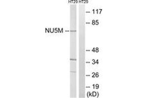 Image no. 1 for anti-Mitochondrially Encoded NADH Dehydrogenase 5 (MT-ND5) (AA 328-377) antibody (ABIN1535072)