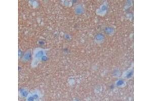 Image no. 2 for anti-Chromosome 6 Open Reading Frame 150 (C6orf150) (AA 225-407) antibody (ABIN5013901)