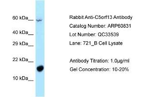 Image no. 1 for anti-Chromosome 5 Open Reading Frame 13 (C5orf13) (N-Term) antibody (ABIN2774298)