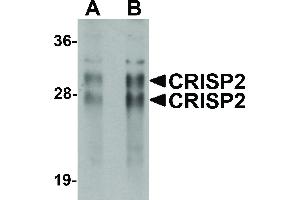Image no. 1 for anti-Cysteine-Rich Secretory Protein 2 (CRISP2) (N-Term) antibody (ABIN6655383)