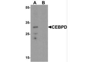 Image no. 1 for anti-CCAAT/enhancer Binding Protein (C/EBP), delta (CEBPD) (C-Term) antibody (ABIN1450037)