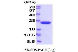 Image no. 1 for Cyclophilin B (PPIB) (AA 34-216) (Active) protein (His tag) (ABIN6388040)