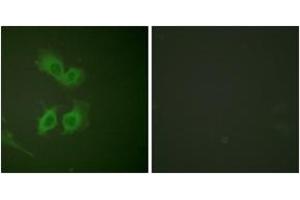 beta Amyloid antibody  (AA 711-760)