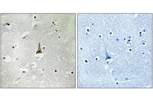 Image no. 1 for anti-Low Density Lipoprotein Receptor Related Protein 10 (LRP10) (AA 204-253) antibody (ABIN1535010)