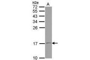 Image no. 2 for anti-Vesicle-Associated Membrane Protein 1 (Synaptobrevin 1) (VAMP1) (AA 1-105) antibody (ABIN1501694)