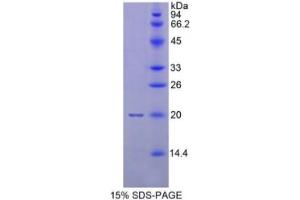Image no. 2 for Matrix Metallopeptidase 9 (Gelatinase B, 92kDa Gelatinase, 92kDa Type IV Collagenase) (MMP9) ELISA Kit (ABIN6730943)