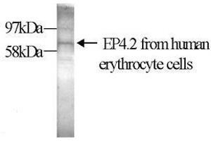 Image no. 1 for anti-erythrocyte Membrane Protein Band 4.2 (EPB42) antibody (ABIN1107098)