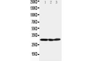 Image no. 1 for anti-Catechol-O-Methyltransferase (COMT) (AA 94-108), (N-Term) antibody (ABIN3042837)