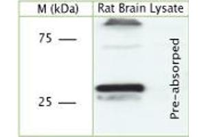 Image no. 3 for anti-Synaptophysin (SYP) (AA 200-260) antibody (ABIN350895)
