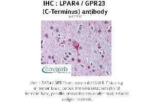Image no. 1 for anti-Lysophosphatidic Acid Receptor 4 (LPAR4) (C-Term), (Cytoplasmic Domain) antibody (ABIN1736525)