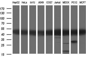 Image no. 4 for anti-Tubulin, alpha 1a (Tuba1a) antibody (ABIN2715957)