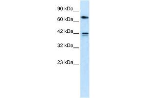 CACNB1 antibody  (N-Term)