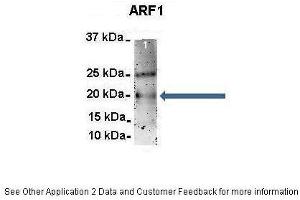 Image no. 4 for anti-ADP-Ribosylation Factor 1 (ARF1) (Middle Region) antibody (ABIN2783267)