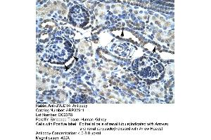 Image no. 3 for anti-Lysine (K)-Specific Demethylase 3A (KDM3A) (C-Term) antibody (ABIN2777661)