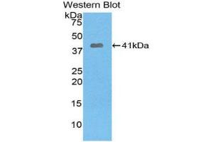Image no. 1 for anti-Pygopus Homolog 1 (Drosophila) (PYGO1) (AA 201-419) antibody (ABIN1860386)