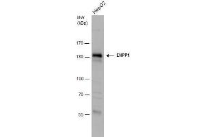 WB Image ENPP1 antibody detects ENPP1 protein by western blot analysis.