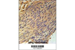 Immunohistochemistry (IHC) image for anti-Cytoplasmic Polyadenylation Element Binding Protein 4 (CPEB4) antibody (ABIN2158348)