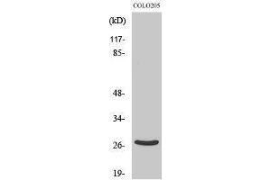Image no. 1 for anti-Dehydrogenase/reductase (SDR Family) Member 2 (DHRS2) (Internal Region) antibody (ABIN3184307)