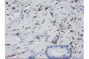 Image no. 1 for anti-Coagulation Factor XIII, A1 Polypeptide (F13A1) antibody (ABIN1498146)