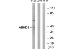 Image no. 1 for anti-Abhydrolase Domain Containing 8 (ABHD8) (AA 291-340) antibody (ABIN1534587)