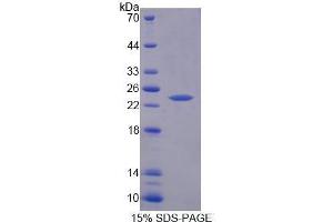 Image no. 1 for Troponin I Type 1 (Skeletal, Slow) (TNNI1) (AA 1-187) protein (His tag) (ABIN1099552)