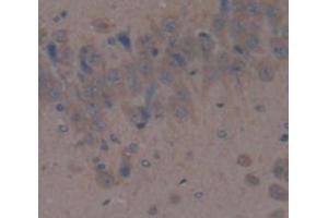 Image no. 2 for anti-Dipeptidyl-Peptidase 4 (DPP4) (AA 638-767) antibody (ABIN1173878)