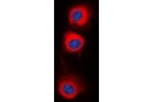 Image no. 1 for anti-Protein Phosphatase 2, Catalytic Subunit, alpha Isozyme (PPP2CA) (C-Term) antibody (ABIN2957734)