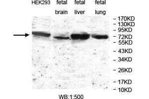 Image no. 1 for anti-Janus Kinase and Microtubule Interacting Protein 1 (JAKMIP1) antibody (ABIN6584222)