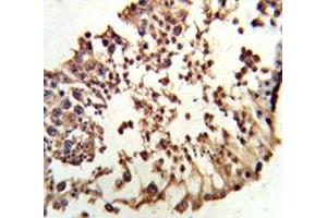 Image no. 2 for anti-Retinoblastoma Protein (Rb Protein) (AA 858-886) antibody (ABIN3029813)