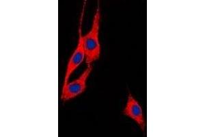 Image no. 1 for anti-Brain-Enriched Guanylate Kinase-Associated (BEGAIN) (C-Term) antibody (ABIN2801399)