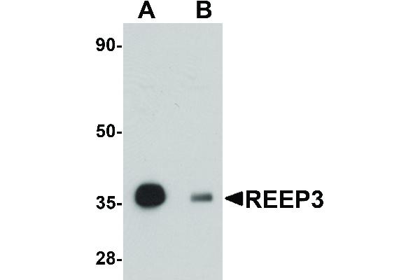REEP3 抗体  (C-Term)