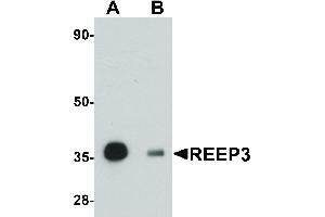 Image no. 1 for anti-Receptor Accessory Protein 3 (REEP3) (C-Term) antibody (ABIN6657194)