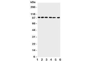 PIAS1 Antikörper  (AA 636-651)