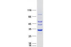 Image no. 1 for Short Chain Dehydrogenase/reductase Family 9C, Member 7 (SDR9C7) protein (Myc-DYKDDDDK Tag) (ABIN2731540)
