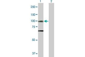 Image no. 1 for anti-Optic Atrophy 1 (Autosomal Dominant) (OPA1) (AA 1-960) antibody (ABIN518525)