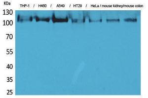 anti-Phospholipase A2, Group IVA (Cytosolic, Calcium-Dependent) (PLA2G4A) (N-Term) antibody