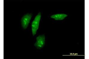 Image no. 2 for anti-SFRS Protein Kinase 2 (SRPK2) (AA 1-699) antibody (ABIN520488)