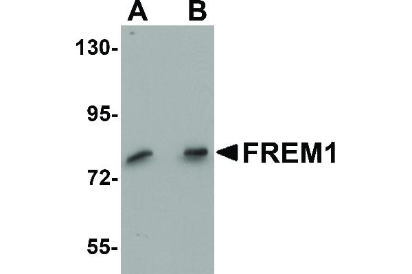 FREM1 antibody  (C-Term)