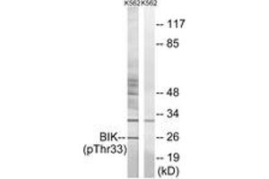 Western blot analysis of extracts from K562 cells, using BIK (Phospho-Thr33) Antibody.
