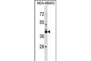 SRRD 抗体  (AA 184-213)